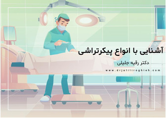 آشنایی با انواع پیکرتراشی و فرق بین لیپوماتیک و پیکرتراشی